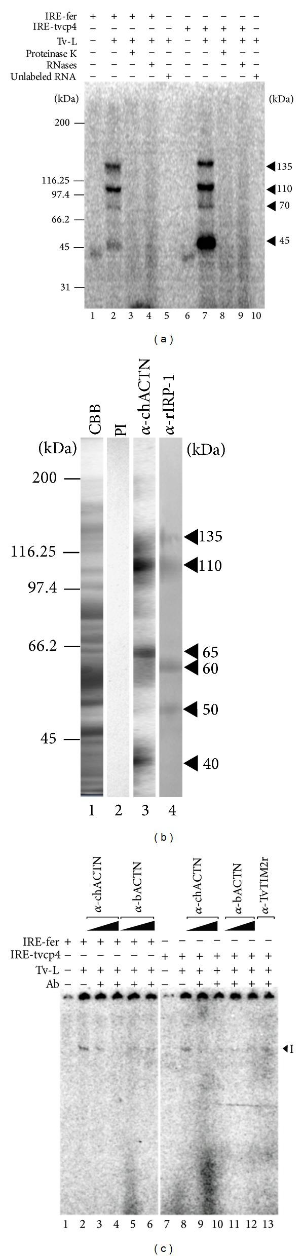 alpha Actinin 1 Antibody in Gel Shift (GS)