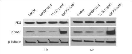 cGKI Antibody in Western Blot (WB)