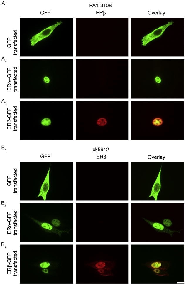 Estrogen Receptor beta Antibody (517700)