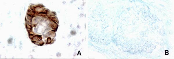 Estrogen Receptor beta Antibody in Immunohistochemistry (IHC)