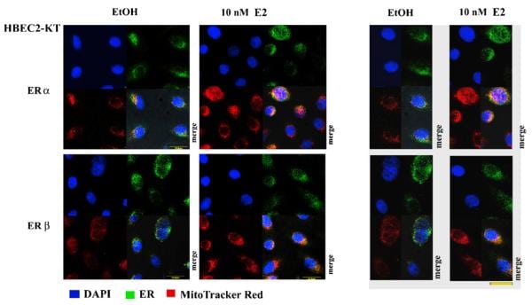 Estrogen Receptor beta Antibody in Immunocytochemistry (ICC/IF)