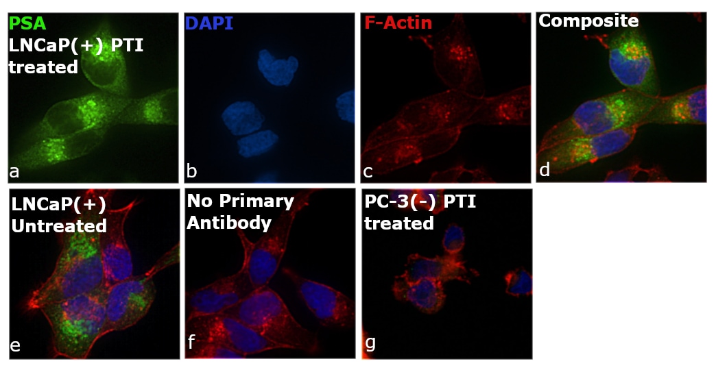 PSA Antibody (PA1-38514)