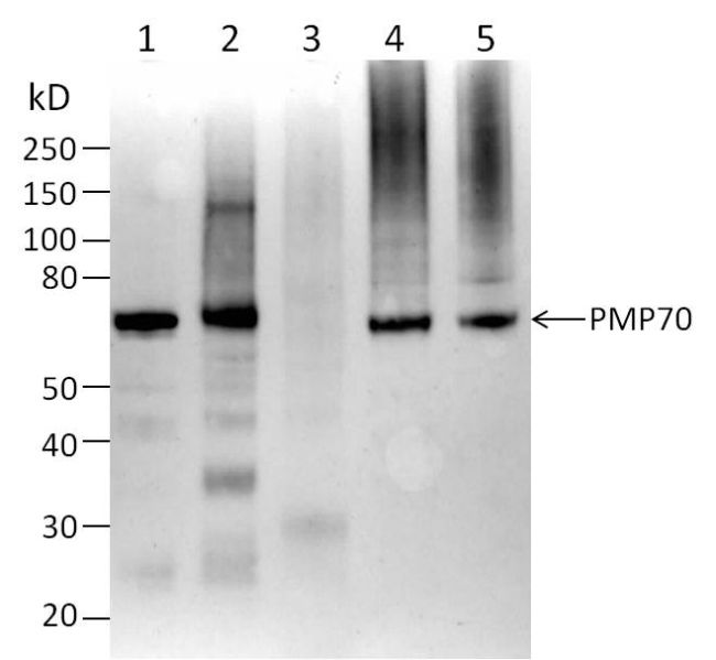 PMP70 Antibody in Western Blot (WB)