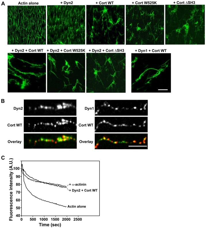 Dynamin 1 Antibody in Immunocytochemistry (ICC/IF)