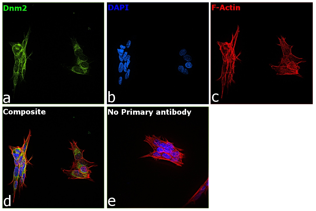 Dynamin 2 Antibody in Immunocytochemistry (ICC/IF)