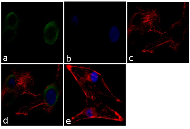 MUNC18 Antibody in Immunocytochemistry (ICC/IF)