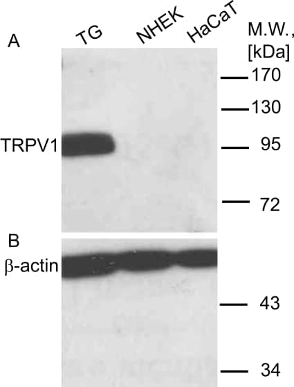 TRPV1 Polyclonal Antibody