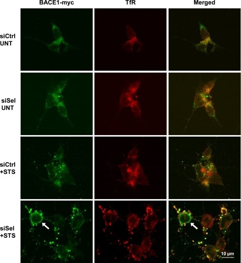 BACE1 Antibody in Immunocytochemistry (ICC/IF)