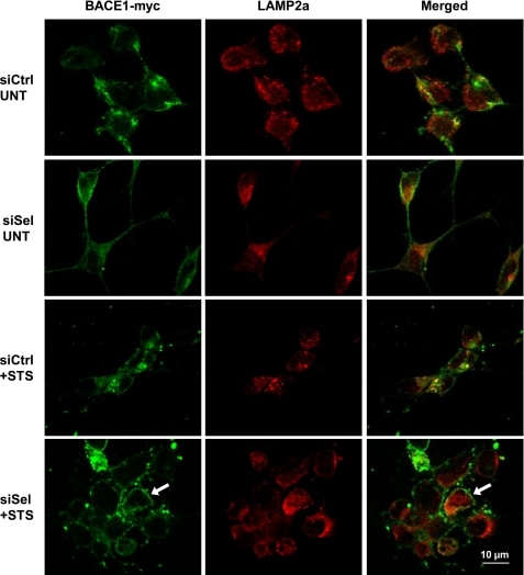 BACE1 Antibody in Immunocytochemistry (ICC/IF)