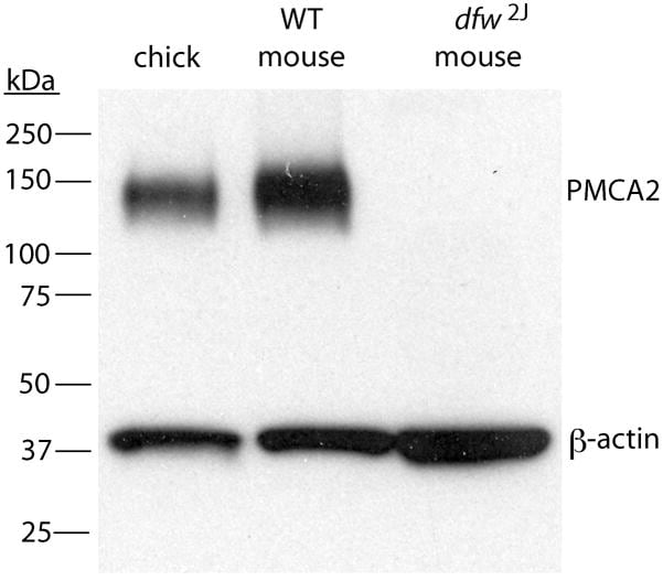 PMCA2 ATPase Antibody in Western Blot (WB)