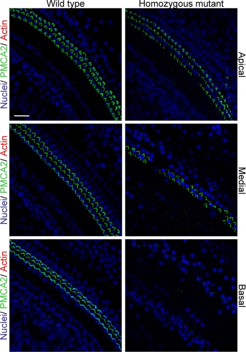 PMCA2 ATPase Antibody in Immunohistochemistry (IHC)