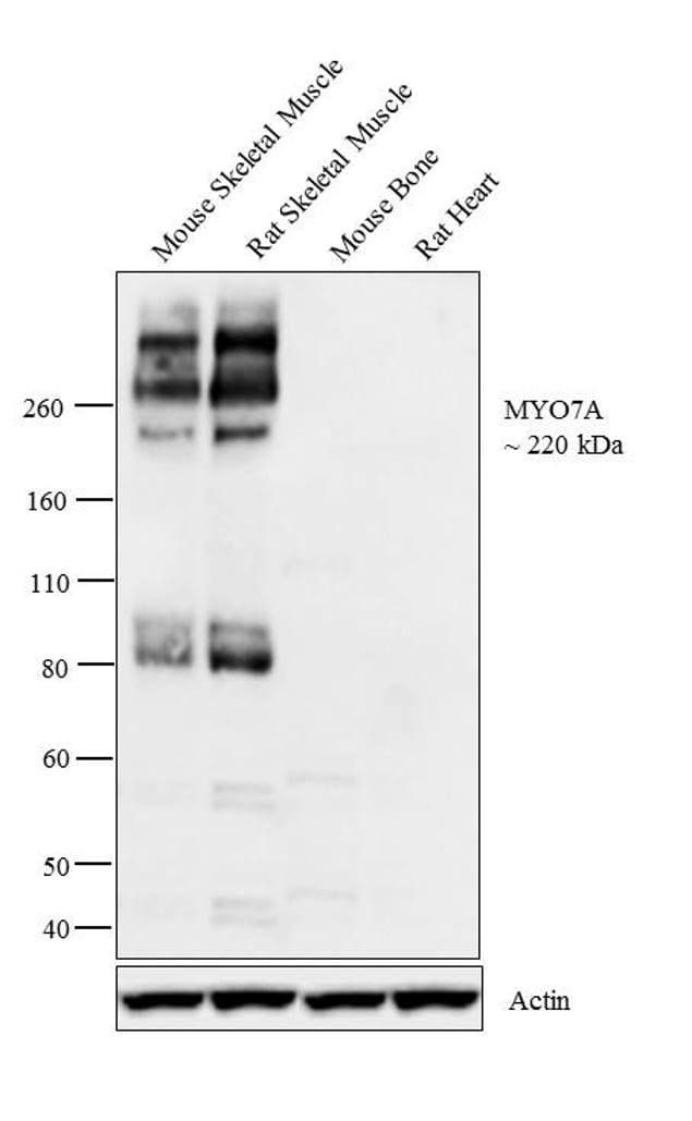 MYO7A Antibody in Western Blot (WB)