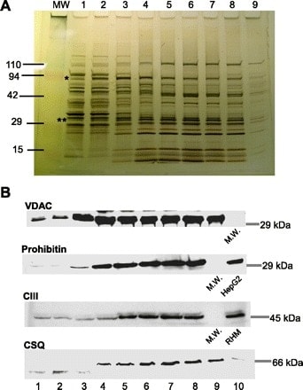 VDAC Antibody in Western Blot (WB)