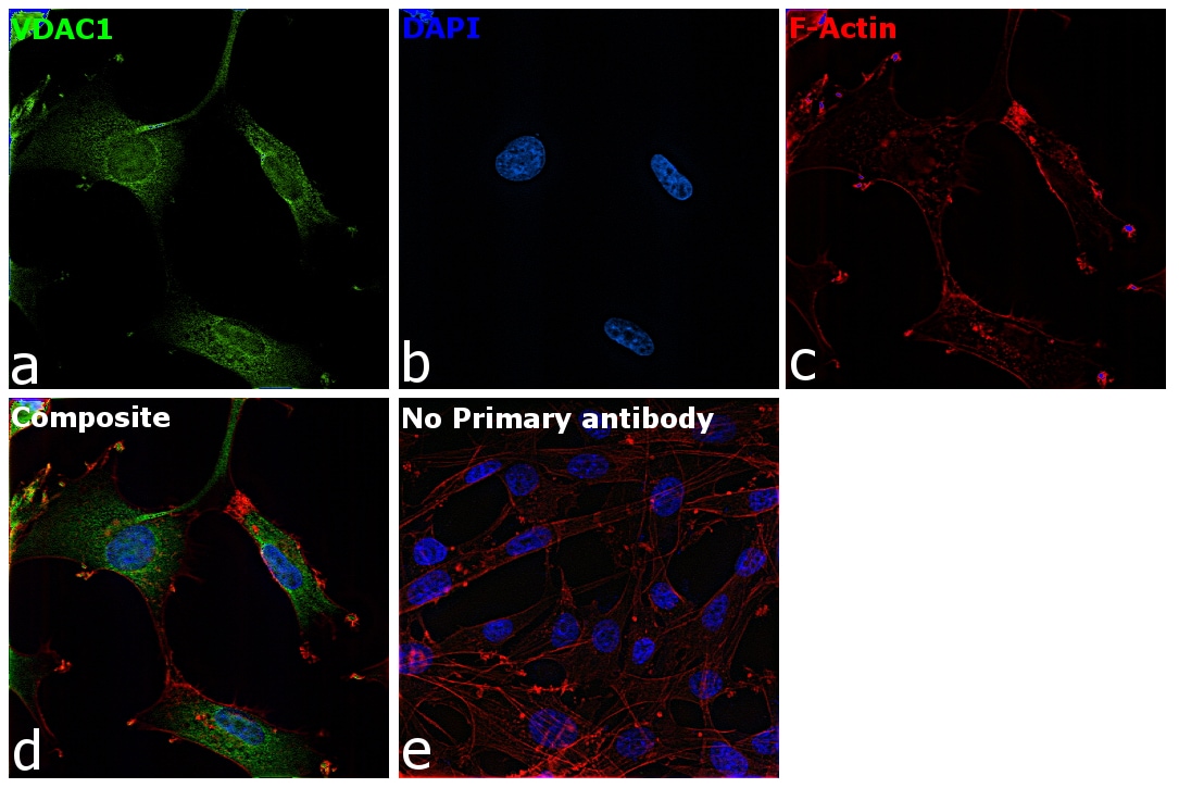 VDAC Antibody in Immunocytochemistry (ICC/IF)