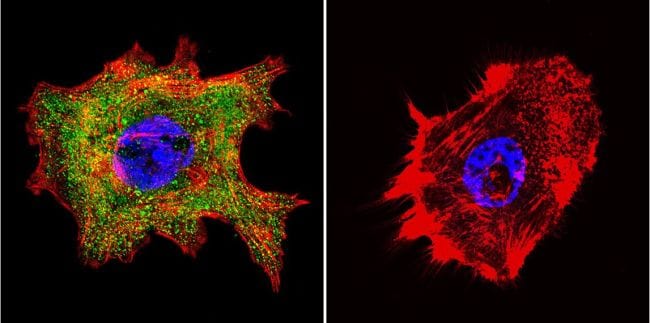 Cyclophilin 40 Antibody in Immunocytochemistry (ICC/IF)