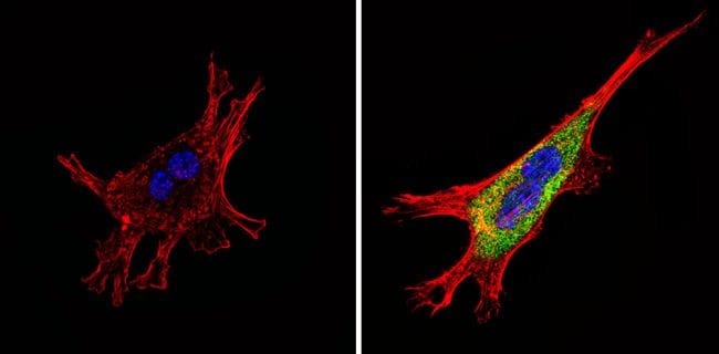 SSTR4 Antibody in Immunocytochemistry (ICC/IF)