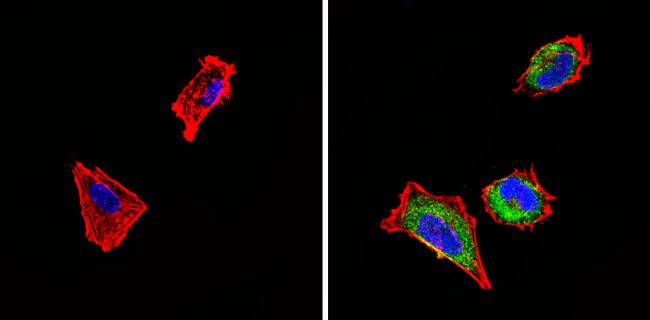 SSTR4 Antibody in Immunocytochemistry (ICC/IF)