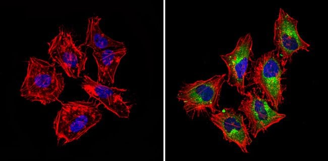 IGF2R Antibody in Immunocytochemistry (ICC/IF)