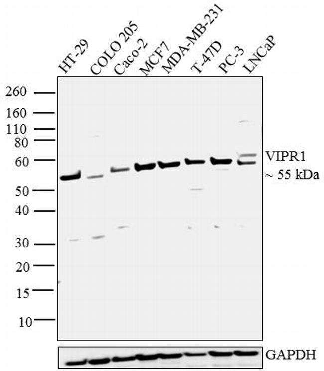 VIPR1 Antibody in Western Blot (WB)