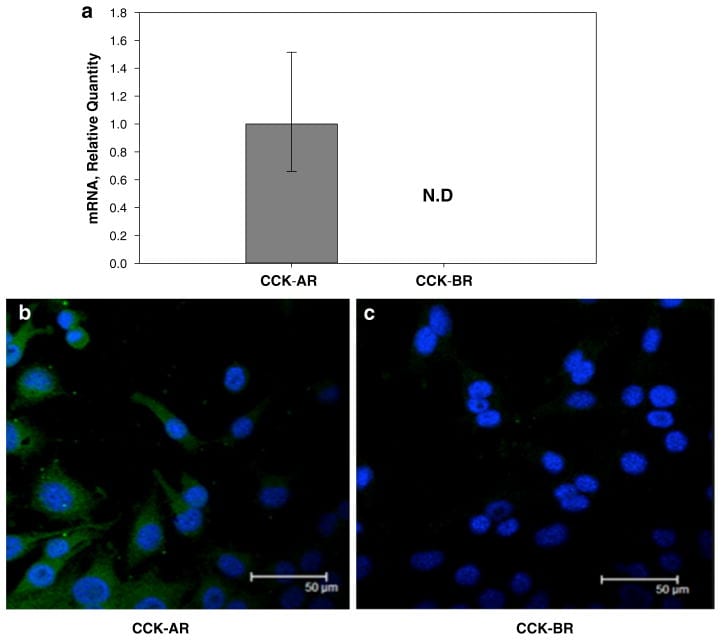 CCKAR Antibody in Immunocytochemistry (ICC/IF)