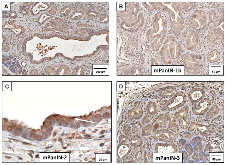 CCKAR Antibody in Immunohistochemistry (Paraffin) (IHC (P))