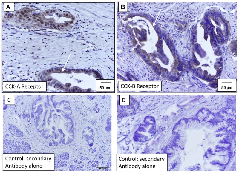 CCKAR Antibody in Immunohistochemistry (Paraffin) (IHC (P))