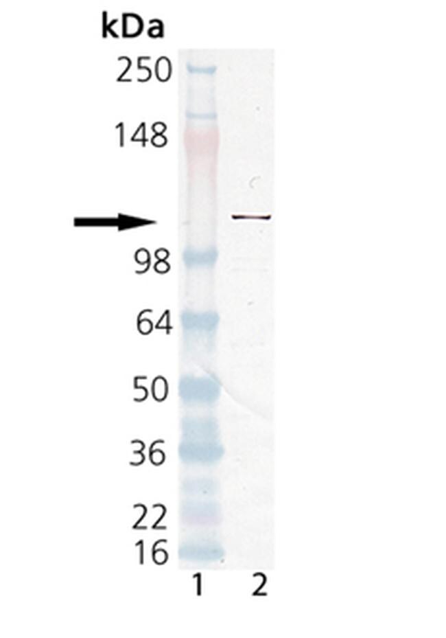 PARP1 Antibody in Western Blot (WB)