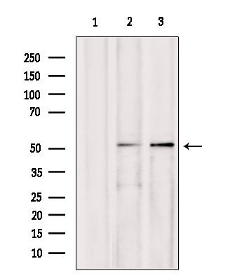AEBP2 Antibody in Western Blot (WB)
