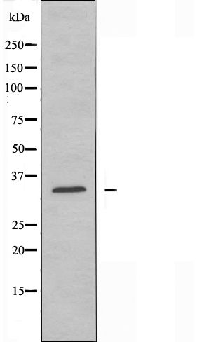 CD32 / FCGR2 Antibody in Western Blot (WB)