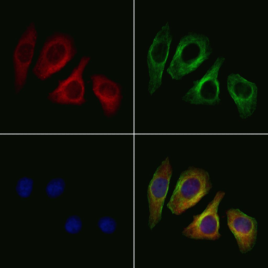 Glypican 3 Antibody (PA5-102528)