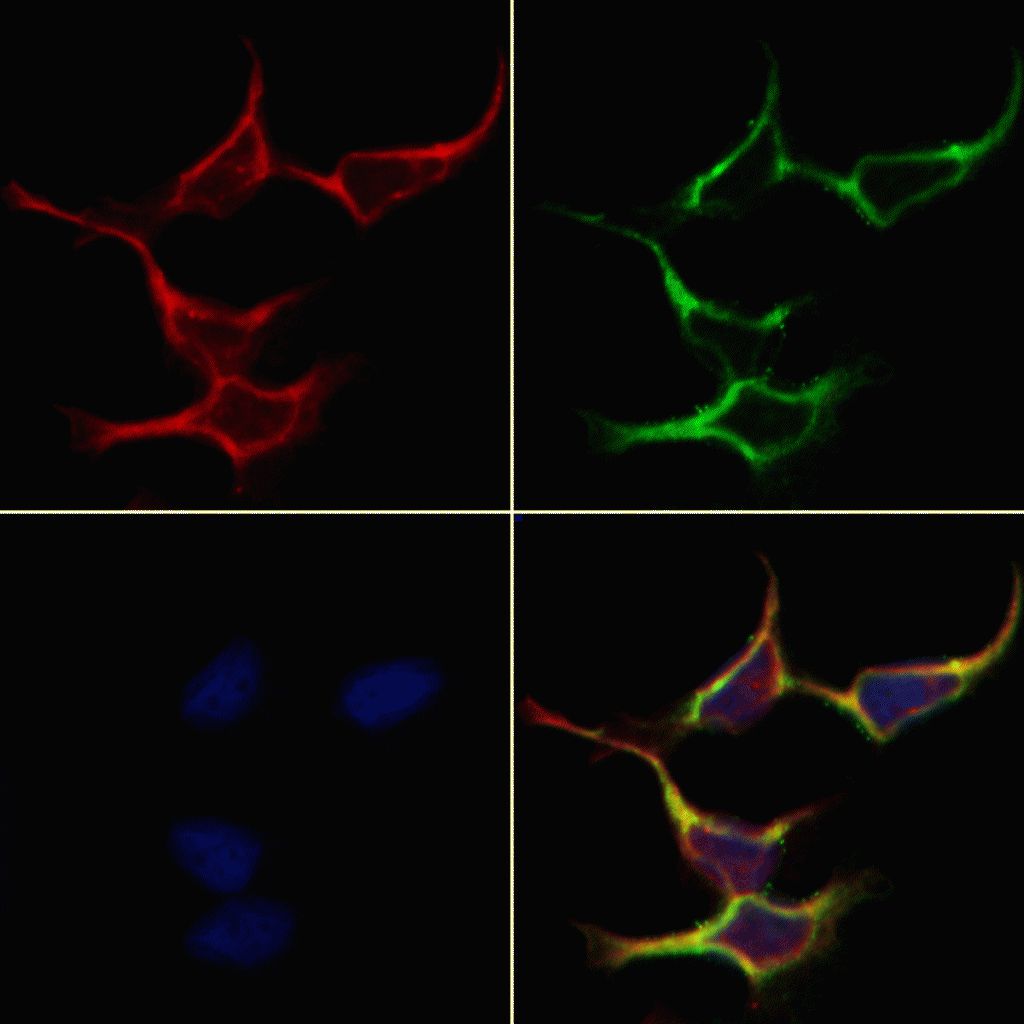 Gad65 Antibody Test Cost