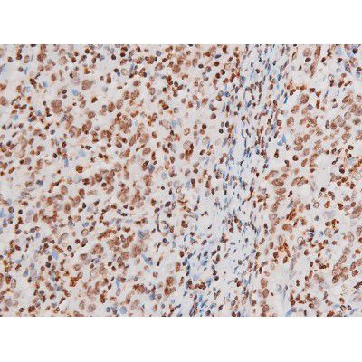 Phospho-NFkB P65 (Thr435) Antibody (PA5-104961)