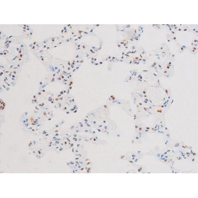 Phospho-NFkB p65 (Ser281) Antibody in Immunohistochemistry (Paraffin) (IHC (P))