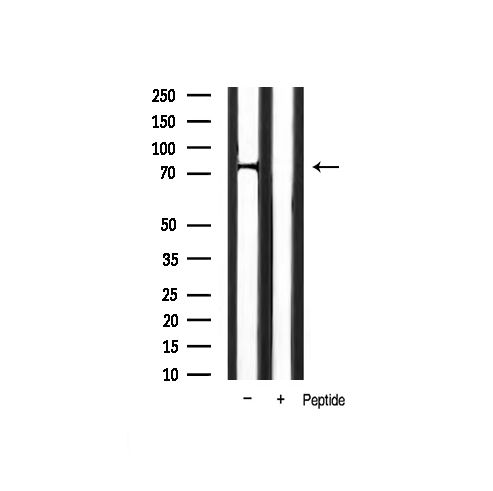 Phospho-FOXO1 (Ser319) Antibody in Western Blot (WB)