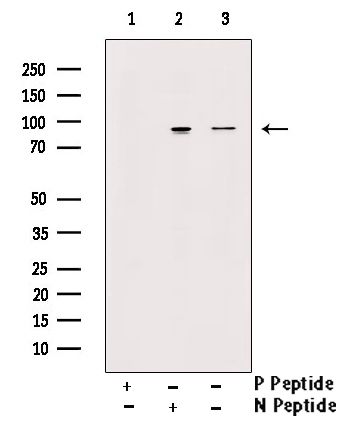 Phospho-TrkA (Tyr496) Antibody in Western Blot (WB)