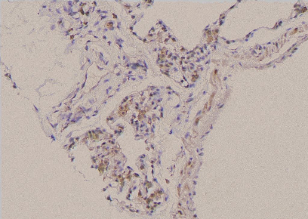 Phospho Eed Thr55 Antibody Pa5 105333