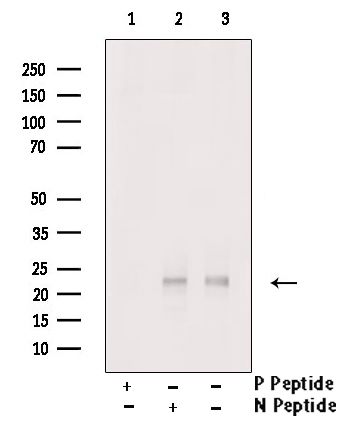 Phospho-TWIST1 (Ser68) Antibody in Western Blot (WB)