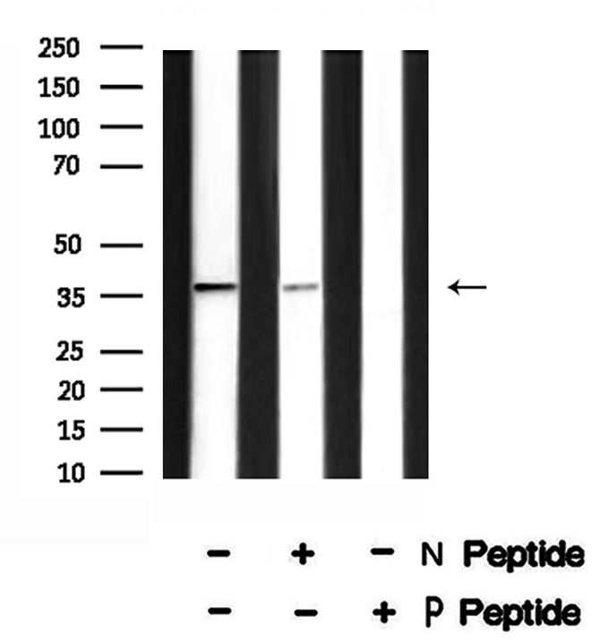 Phospho-RAD51 (Thr309) Antibody in Western Blot (WB)