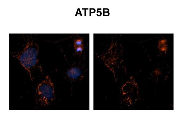ATP Synthase beta Antibody in Immunohistochemistry (IHC)