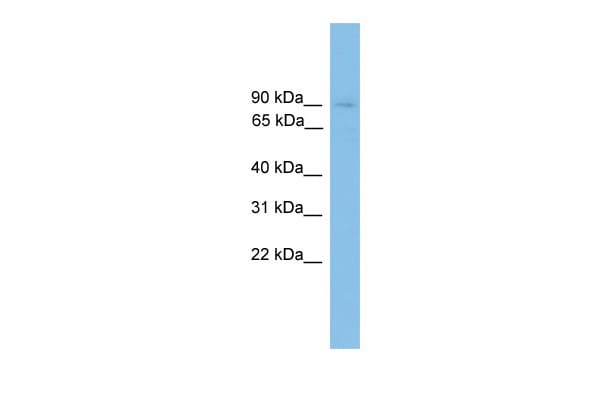 Hnrnp U Antibody Pa5 107145