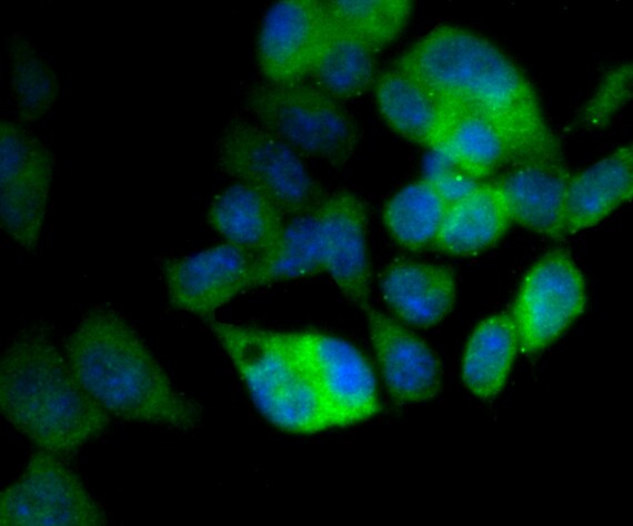 LRP8 Antibody (PA5-109269)