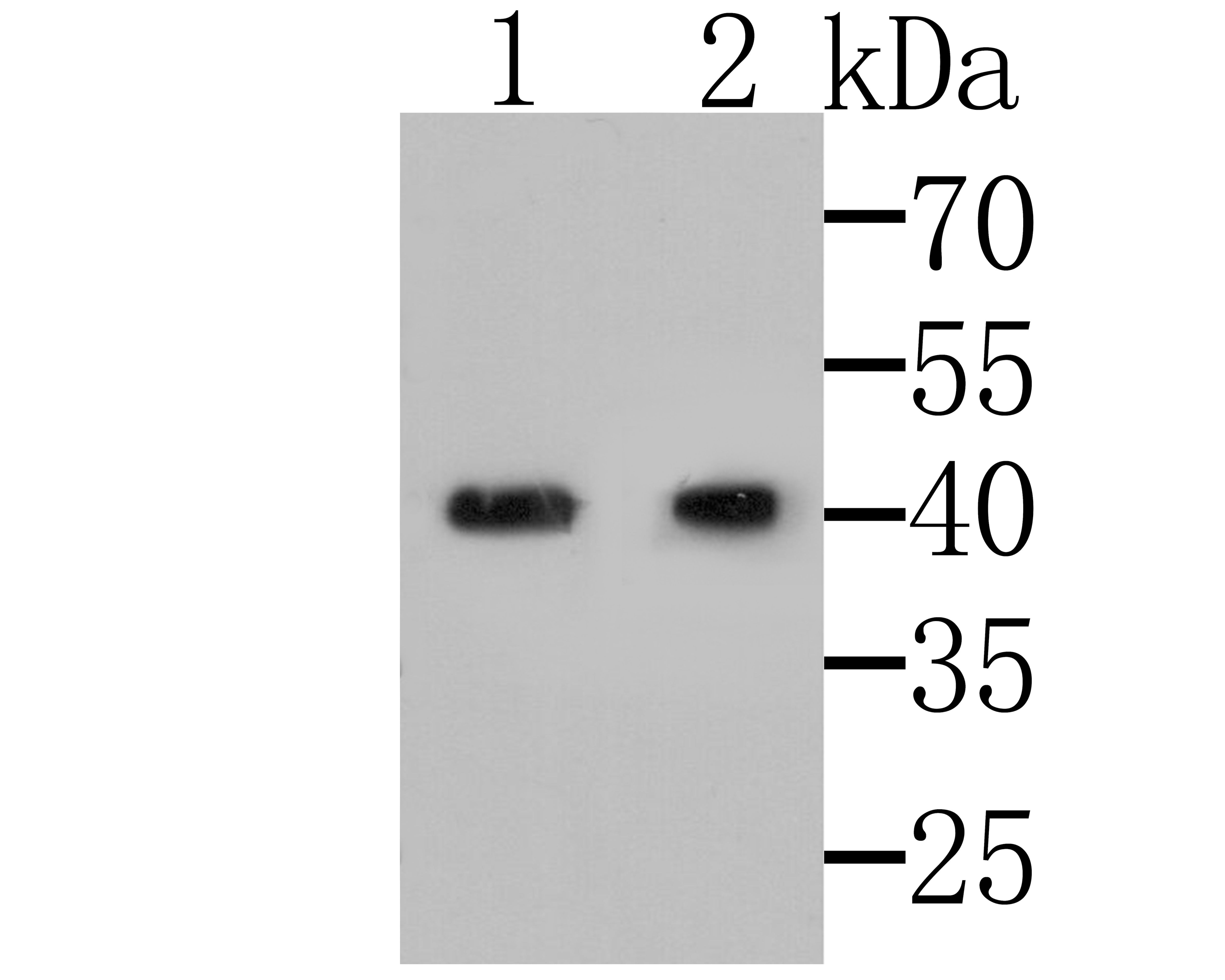 MICA/B Antibody (PA5-109323)