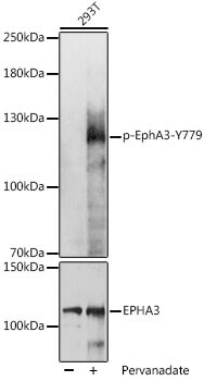 Phospho-EphA3 (Tyr779) Antibody in Western Blot (WB)