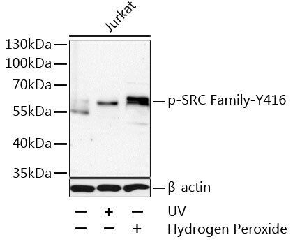 Phospho-LCK/FYN (Tyr416) Antibody (PA5-110156)