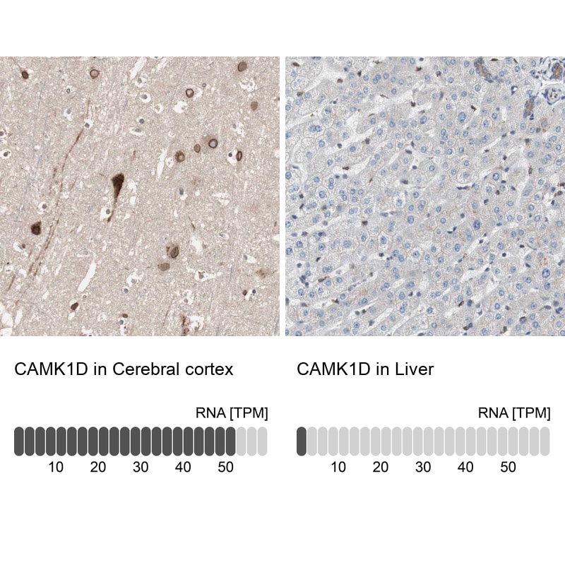CAMK1D Antibody in Immunohistochemistry (IHC)