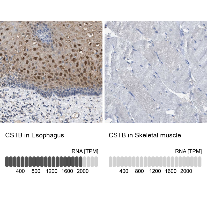 Cystatin B Antibody (PA5-110828)