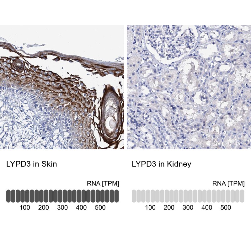 LYPD3 Antibody in Immunohistochemistry (IHC)