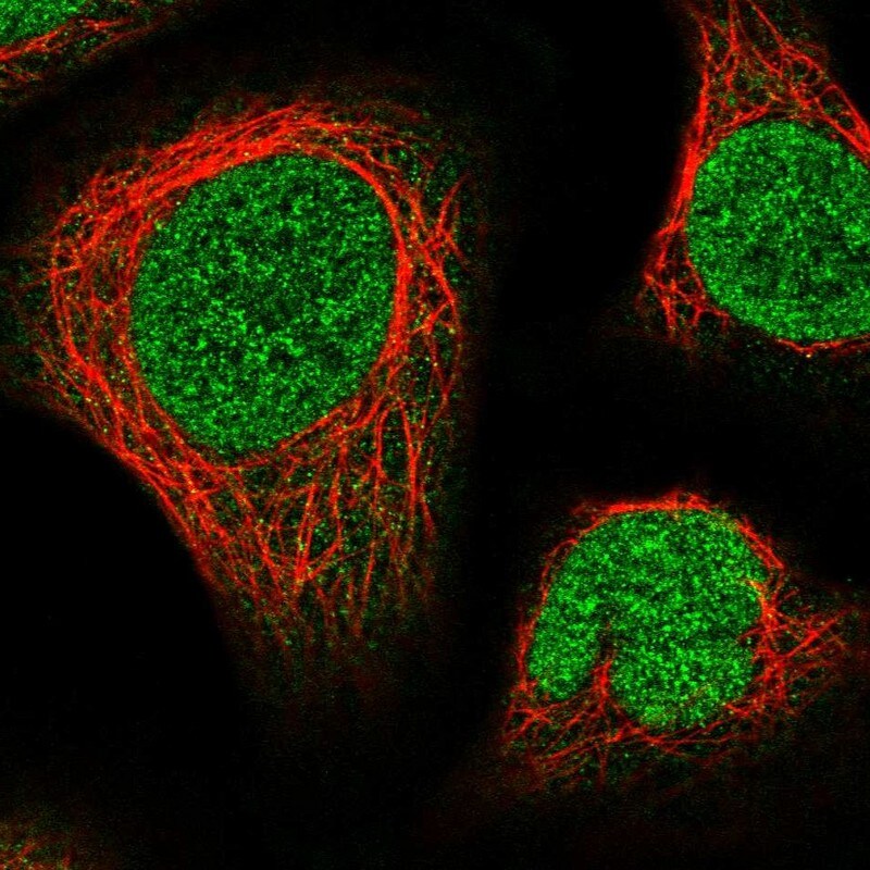 NUP214 Antibody (PA5-111282)