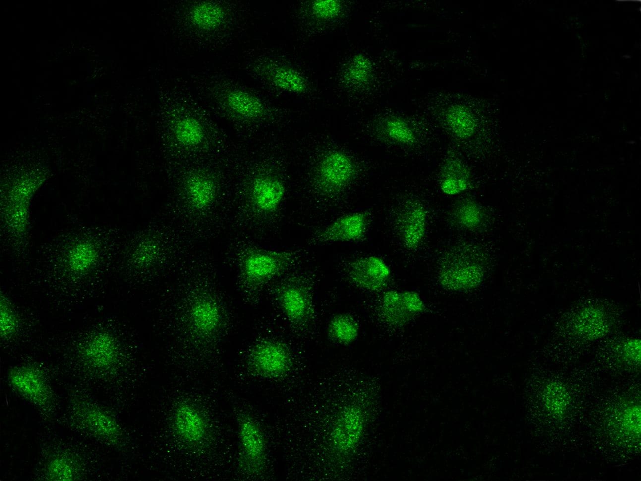 MAD2 Antibody (PA5112175)