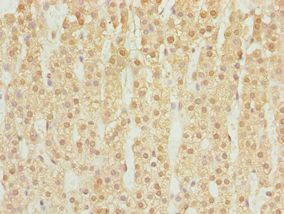 DHRS3 Antibody in Immunohistochemistry (Paraffin) (IHC (P))